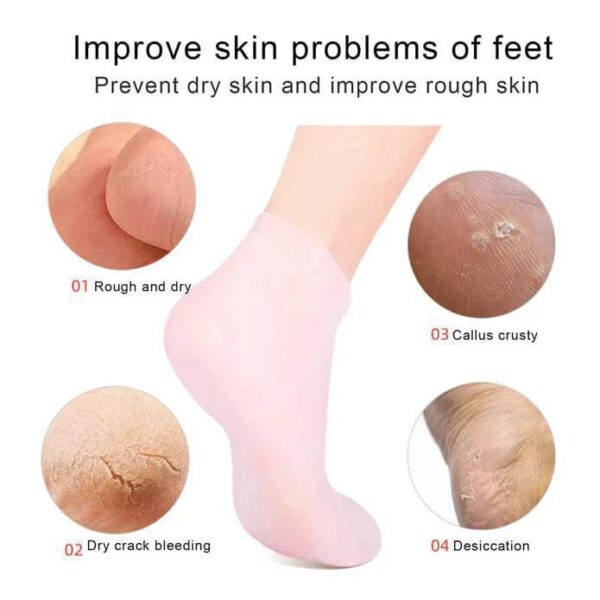 WhatsApp Image 2025-12-31 at 12.31.32 PM Silicone Jelly Socks | Ultra-Moisturizing Gel Foot Care & Spa Therapy | Without Box